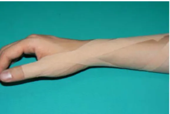 Figure 1.  Method  of  taping. 