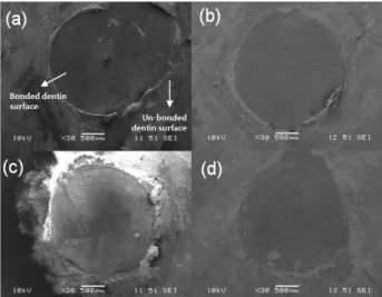 Figure  4.  In  light-cure  mode,  scanning  electron  microscope  image  of  adhesive  failure  at  dentin  (original  magnification  30x)