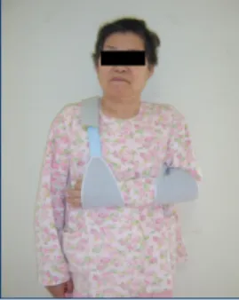 그림  2.  Rolyan  humeral  cuff  sling
