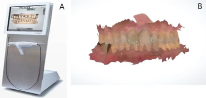 Figure  6.  3Shape  Trios  Intraoral  Scanner(A)  and  Scanned  image(B) II.  디지털  인상의  한계점     대부분이  수작업으로  시행되는  보철  제작과정  중  특 히  인상채득은  환자나  술자에게  매우  힘들고  오류가  많 이  발생하는  과정이다
