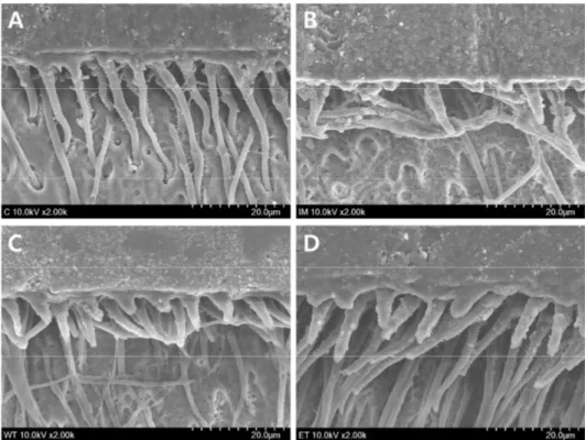 Figure 2. Representative SEM micrographs showing hybrid layer and resin penetration in the fractured dentin sides