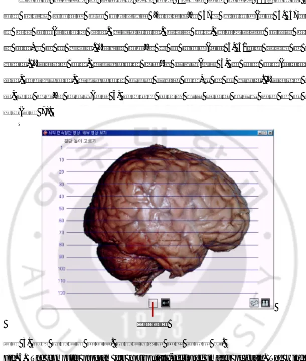 Fig. 3.  The computer program for horizontally-sectioned images of brain. The window  indicates that several levels of horizontally-sectioning can be selected