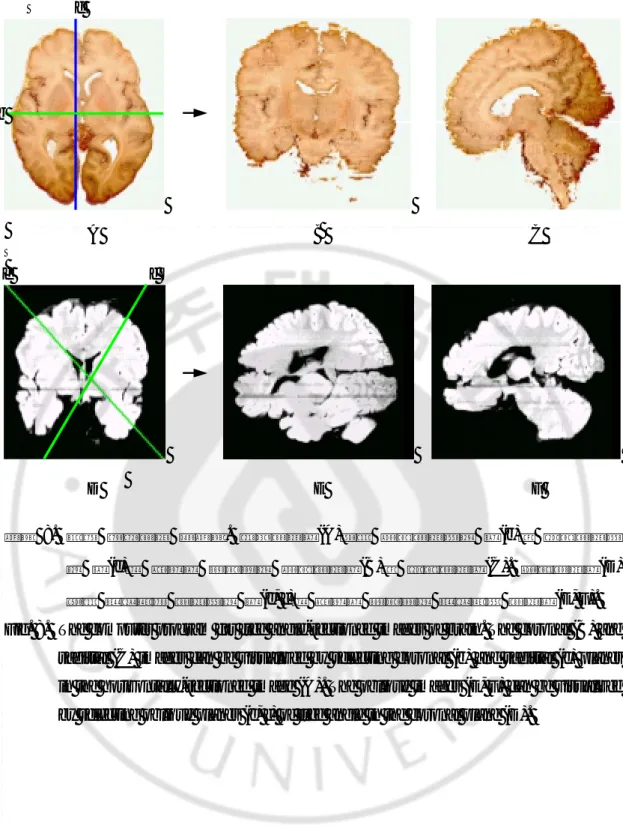그림 8.  뇌의  자유절단  풀그림.  수평절단면(A)에서  관상절단하는  면(b)과  시상절단하 는  면(c)을  고르면  나타나는  관상절단면(B)과  시상절단면(C)