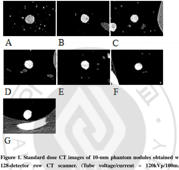 Figure  1.  Standard  dose  CT  images  of  10-mm  phantom  nodules  obtained  with  128-detector  row  CT  scanner