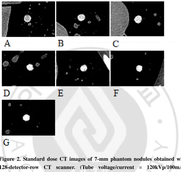 Figure  2.  Standard  dose  CT  images  of  7-mm  phantom  nodules  obtained  with  128-detector-row  CT  scanner