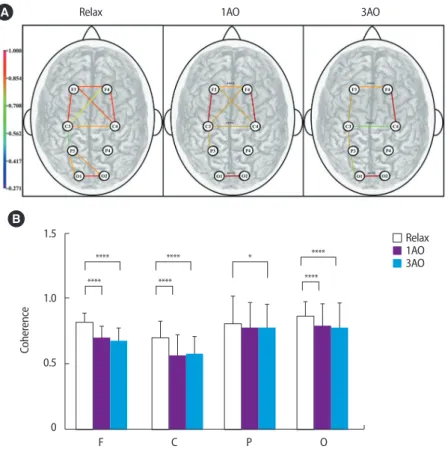 Figure 3.Coherenceofthehighalphawave.(A)Mapofthebrain.Linesrepresentcoherencebetweenlinkedareas.(B)Coherenceoftheinter- 3.Coherenceofthehighalphawave.(A)Mapofthebrain.Linesrepresentcoherencebetweenlinkedareas.(B)Coh