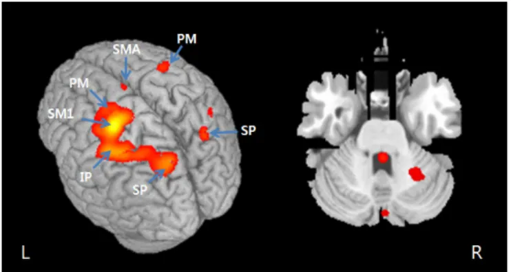 Figure 1. Cortical and cerebellar activations during serial  reaction time task. 