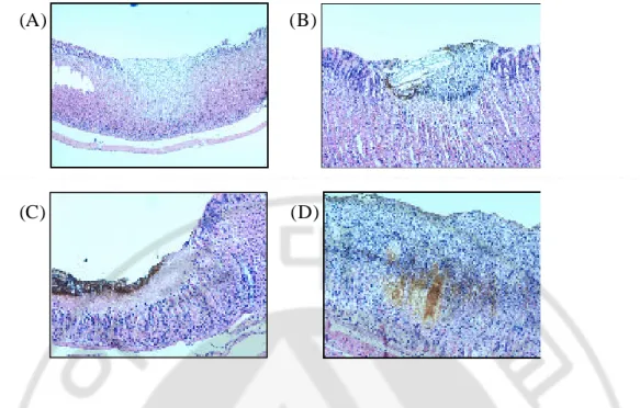 Fig.  3.  Microscopic  observation  of  WIRS-induced  gastric  mucosa  in  rats  with 