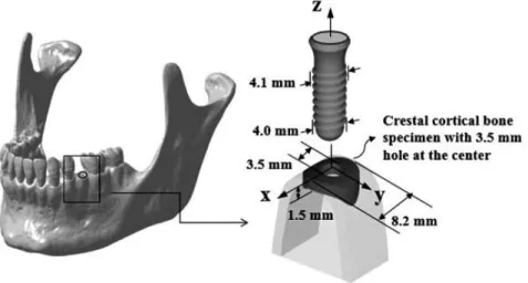 Figure  1.    Analysis  model:  geometry  and  dimensions  of  the  implant  and  the  crestal  cortical  bone  specimen.
