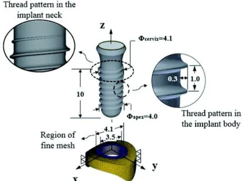 Figure  2.    The  FEM  simulation/analysis  model  consisting  of  the  implant  and  the  crestal  cortical  bone  specimen.