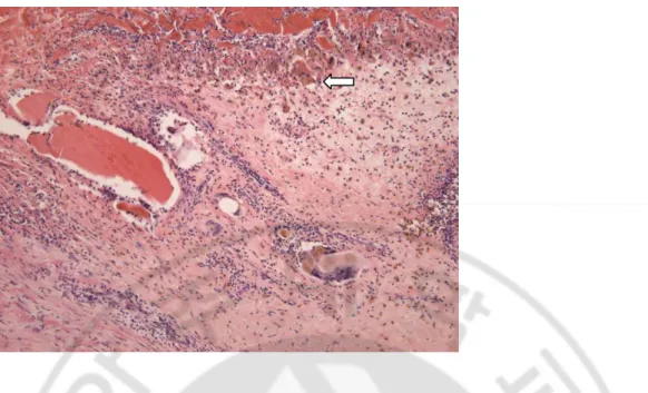 Fig.  6.  Histologic  appearance  of  completely  ablated  dog  gallbladder  wall.  Completely 