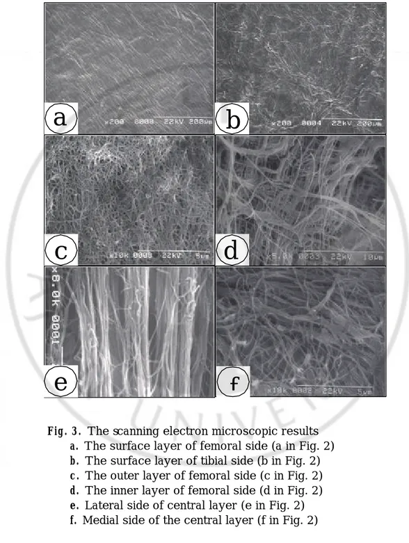 Fig. 3.  The scanning electron microscopic results  a.  The surface layer of femoral side (a in Fig
