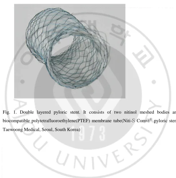 Fig. 1. Double layered  pyloric  stent.  It consists  of two nitinol meshed bodies  and  biocompatible  polytetrafluoroethylene(PTEF)  membrane  tube(Niti-S  Comvi Ⓡ   pyloric stent,  Taewoong Medical, Seoul, South Korea) 