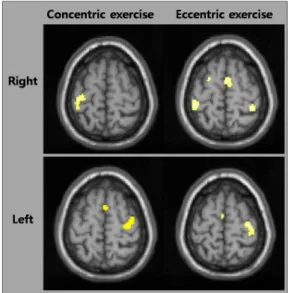 Figure 1. The representative fMRI results showing cortical  activation during concentric and eccentric exercise in the  right and left hand.