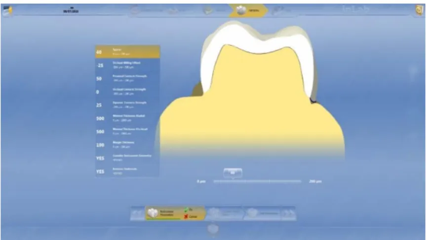 Figure  1.  Crown  design  using  CAD/CAM  software  in  CEREC  system  (parameter  setting).