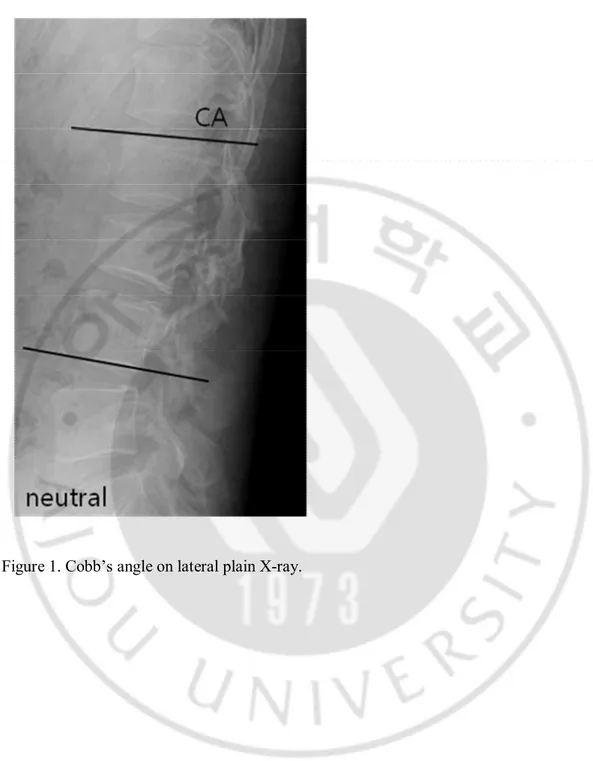 Figure 1. Cobb’s angle on lateral plain X-ray. 