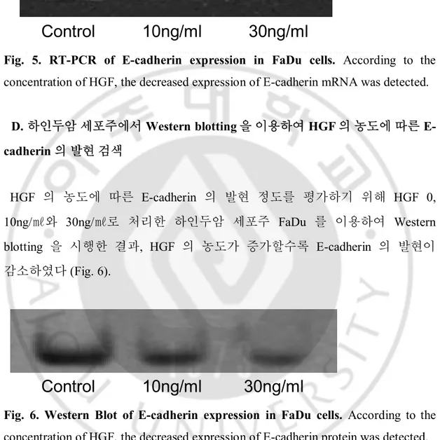 Fig.  5.  RT-PCR  of  E-cadherin  expression  in  FaDu  cells.  According  to  the 