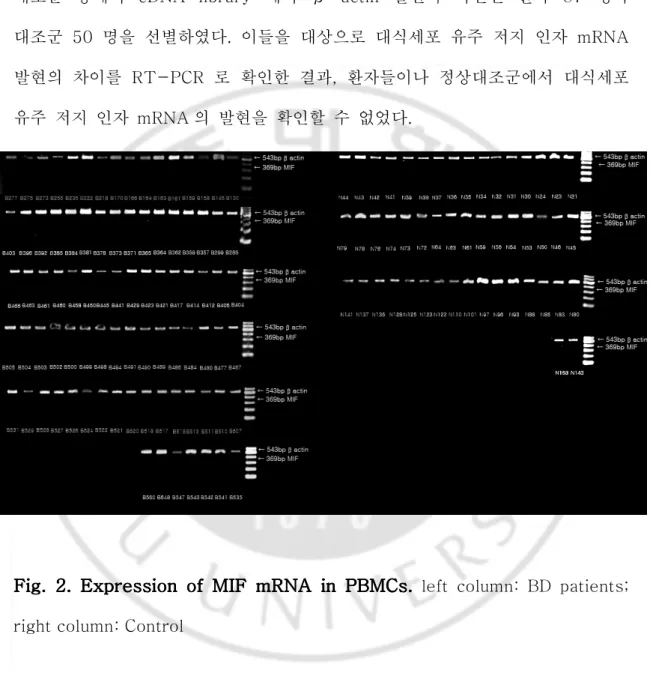 Fig.  2.  Expression  o   2.  Expression  o   2.  Expression  o   2.  Expression  of  MIF  mRNA  in  PBMCs f  MIF  mRNA  in  PBMCs f  MIF  mRNA  in  PBMCs f  MIF  mRNA  in  PBMCs