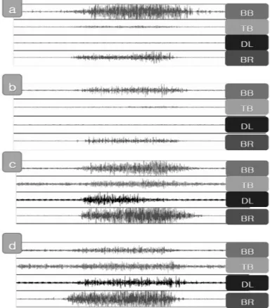Figure 4. Comparison of C4 slope time of movement  related cortical potentials (MRCPs) during concentric  and eccentric contractions