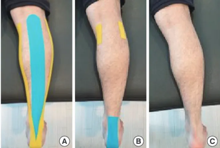Figure 1.Threedifferenttapingconditions.(A):Kinesiotaping,(B):