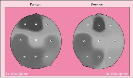 Table 2. The comparison of motor reaction time between the pre‐test and the post‐test