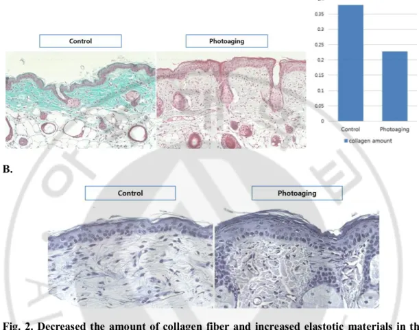 Fig. 2. Decreased the  amount of collagen  fiber  and increased elastotic  materials in the  dermis  after  photoaging