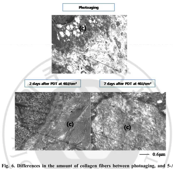 Fig.  6.  Differences  in  the  amount  of  collagen  fibers  between  photoaging,  and  5-ALA  PDT group with transmission electron microscopy