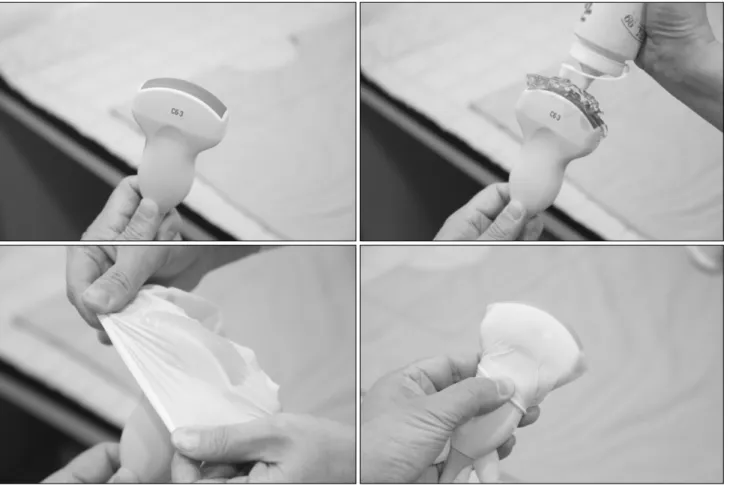 Fig. 2. Transducer preparing with gel and powderless glove .