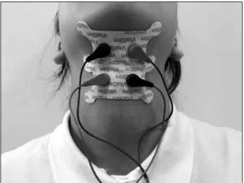 Fig.  1.  Electrode  placement.