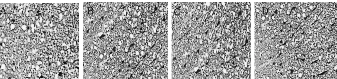 Figure 4.  Immunohistochemistric  response  of  BDNF  appeared  in  spinal  cord.  (A:  7day  CON,  B:  7day  SWIM,  C: 