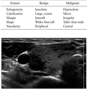 Table 1. Ultrasonographic Features Associated with Benign and  Malignant Thyroid Nodules