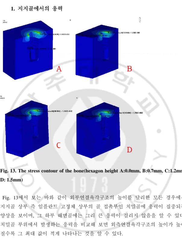 Fig. 13. The stress contour of the bone(hexagon height A:0.0mm, B:0.7mm, C:1.2mm,  D: 1.5mm)      Fig