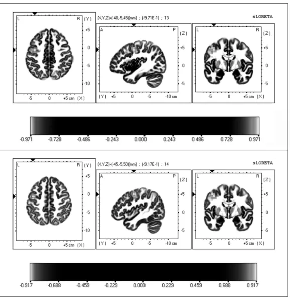 Fig. 2. Continued 4. 군으로부터 변이가 큰 것이 정상군에 가깝게 변이가 감소되 는 것으로 볼 수 있다. 따라서 침치료가 중추신경계에 영향 을  미침으로써  불면에  효과를  나타내는  것으로  해석할  수  있다