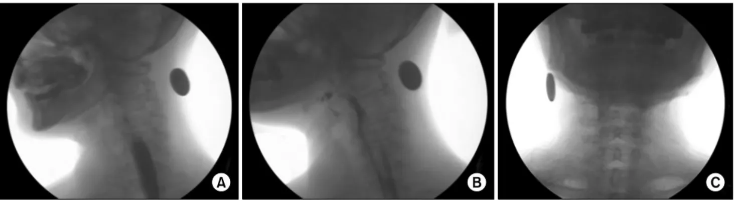 Fig.  2.  (A)  Before  the  Injection. 
