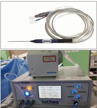 Fig. 1. Bile duct injury after intraoperative radiofrequency ablation. Fig. 2. Electrode, circulation pump and current generator.