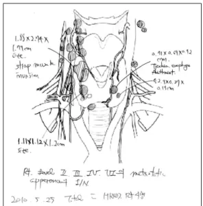 Fig. 1. Schematic picture of neck as a result of preoperative US. 