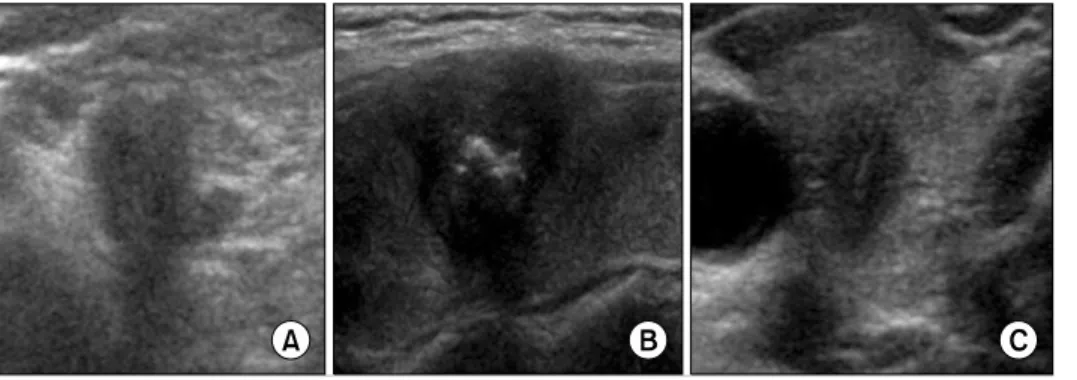 Fig. 1. Categorization of ultrasound  results with relationship between  tumor and thyroid capsule