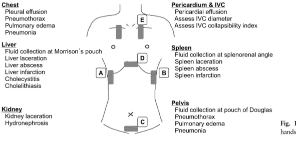 Fig. 1. Findings to look for during  hands-on session.