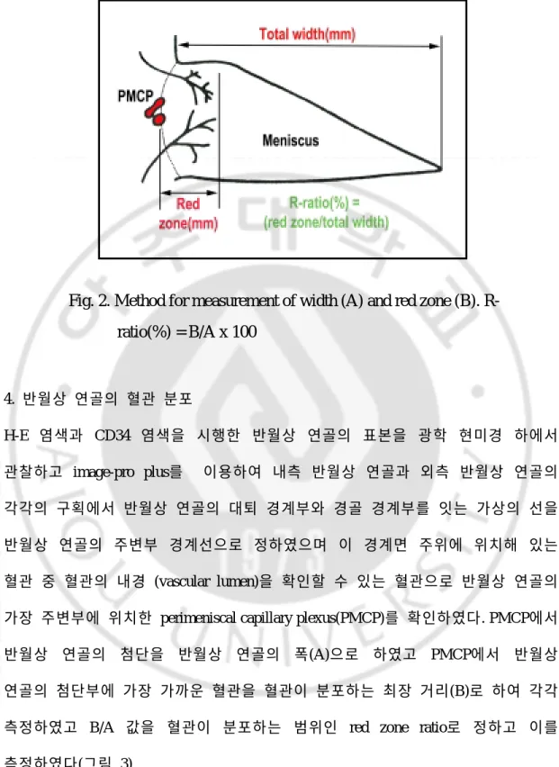 Fig. 2. Method for measurement of width (A) and red zone (B). R- R-ratio(%) = B/A x 100 4
