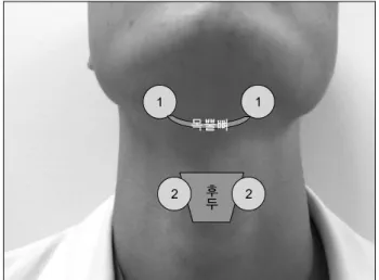 Fig.  1.  Submental  area. Fig.  2.  Submental  &amp;  thyrohyoid  (horizontal)  area