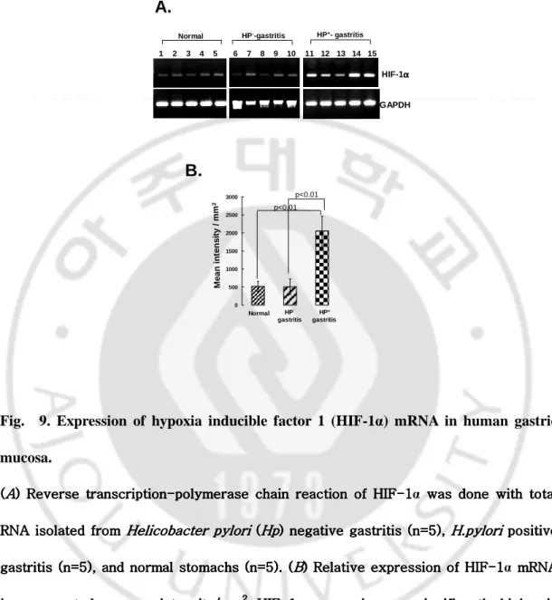 Fig.    9.  Expression  of  hypoxia  inducible  factor  1  (HIF-1α)  mRNA  in  human  gastric  mucosa