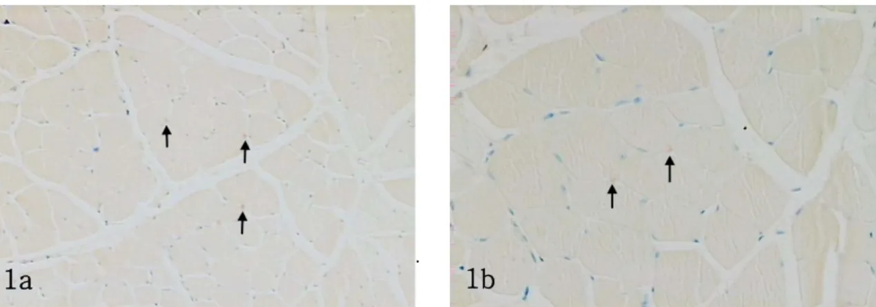 Figure 1.  Immunoreactivity  with  the  NT-3  antibody  in  normal  group.  NT-3  immunoreactivity  observed  in  a  little  neuromuscular  junction(arrows)(a:  ×200,  b:  ×400).
