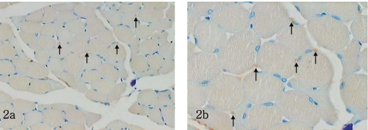 Figure 2.  Immunoreactivity  with  the  NT-3  antibody  in  control  group.  NT-3  immunoreactivity  observed  in  some  neuromuscular  junction(arrows)(a:  ×200,  b:  ×400).