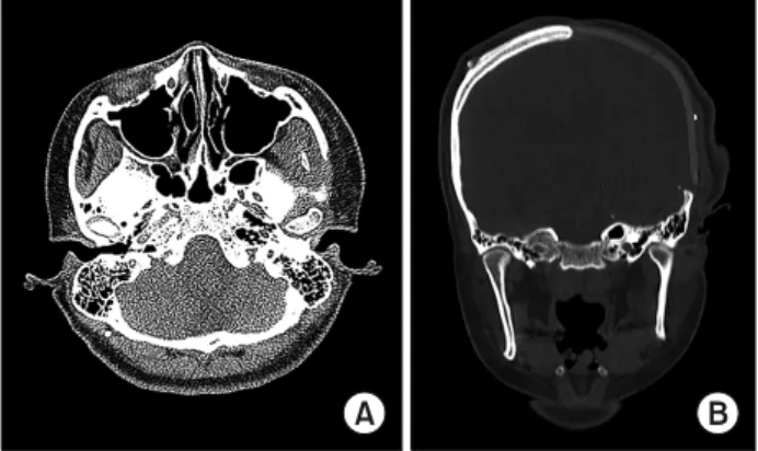 Fig.  1.  Radiographic  images  of  TMJ. 