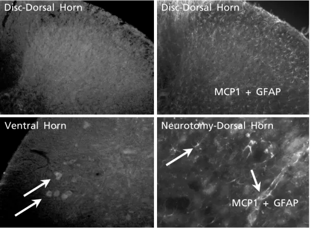 Figure 4. MCP‐1 mRNA expression of in ipsilateral and contralateral dorsal horn in the experimental group and sham group