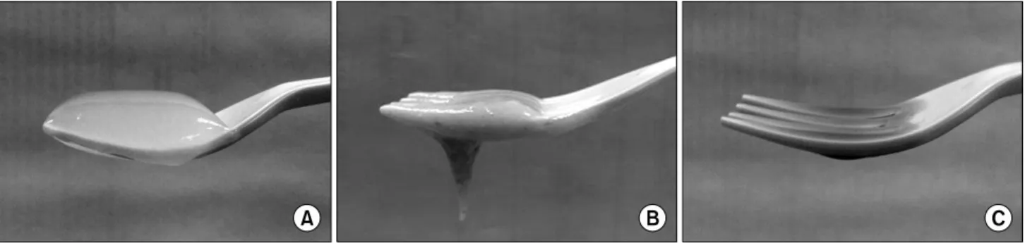Fig.  1.  Fork  test.  (A)  Grade  1.  The  food  only  remains  on  the  fork  and  never  flows  between  the  tines
