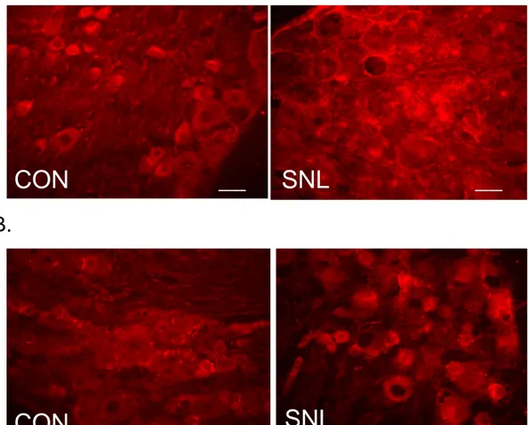 Fig.  5.  Immunohistochemical  photograph  of  COX-1  and  COX-2  expression  in  spinal  nerve-ligated  DRG(SNL)