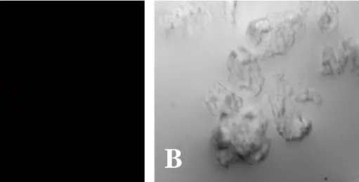 Fig.  2.  Naegleria  fowleri  trophozoites  stained  only  with  the  fluorescein  isothiocyanate(FITC)-conjugated  anti-mouse  immunoglobulin  G