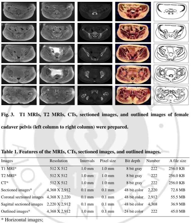 Fig. 3.  T1 MRIs, T2 MRIs, CTs, sectioned images, and outlined images of female  cadaver pelvis (left column to right column) were prepared