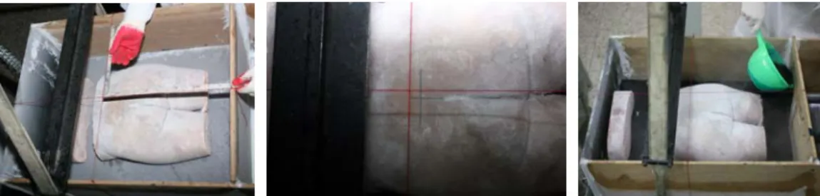 Fig. 6.  Horizontal and sagittal threads are verified using a square (left) and a cross- cross-line drawn on the pelvis correspond to the threads (middle)